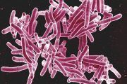 Según la OMS la tercera parte de la población mundial está infectada con Mycobacterium tuberculosis