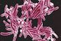 Según la OMS la tercera parte de la población mundial está infectada con Mycobacterium tuberculosis