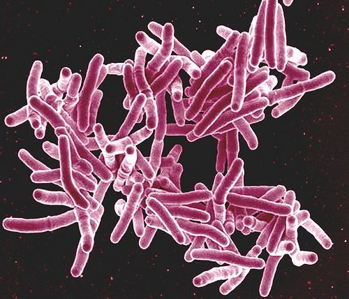 Según la OMS la tercera parte de la población mundial está infectada con Mycobacterium tuberculosis