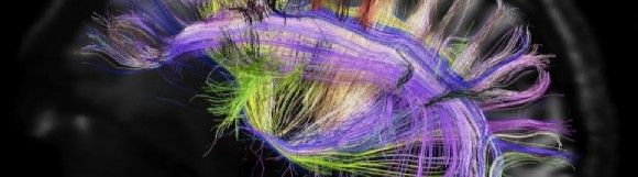 human_brain
