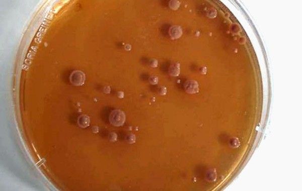 Exposición al riesgo biológico. El principio de universalidad en la prevención de riesgos laborales: precauciones universales