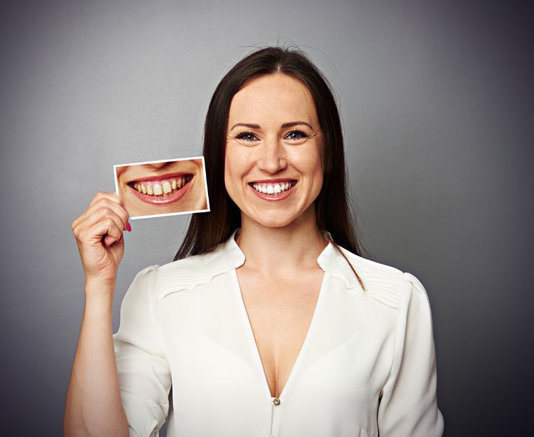 ¿ Sabias que el estrés puede acabar con tu dentadura ?