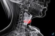 Enfermedad Profesional: El cáncer de laringe por inhalación de amianto