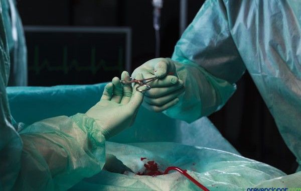 Evaluación de la carga física durante las intervenciones quirúrgicas de larga duración