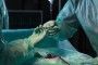 Evaluación de la carga física durante las intervenciones quirúrgicas de larga duración