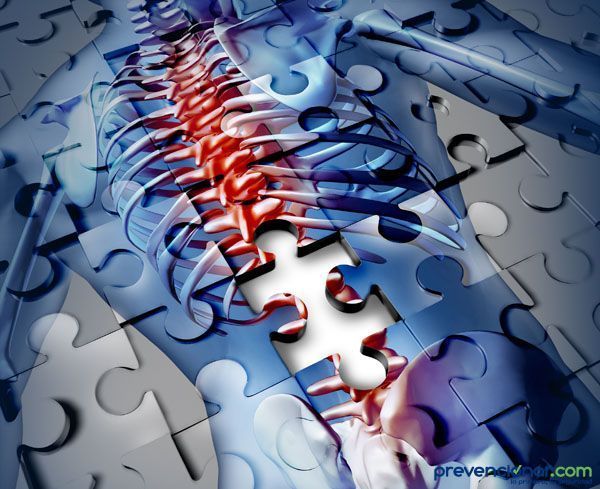 columna_vertebral_método_ocra