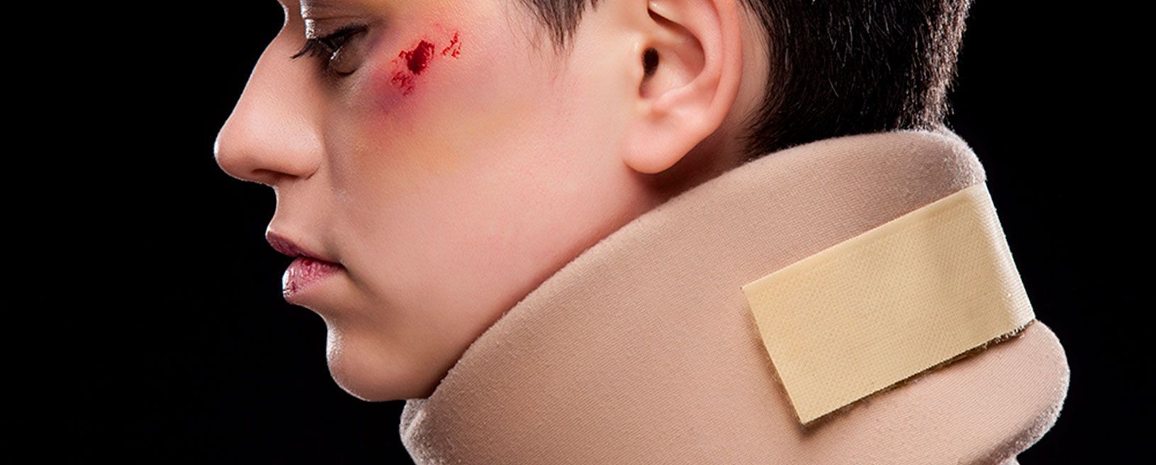 Los esguinces cervicales causan el 53% de las bajas por Accidente de Tráfico