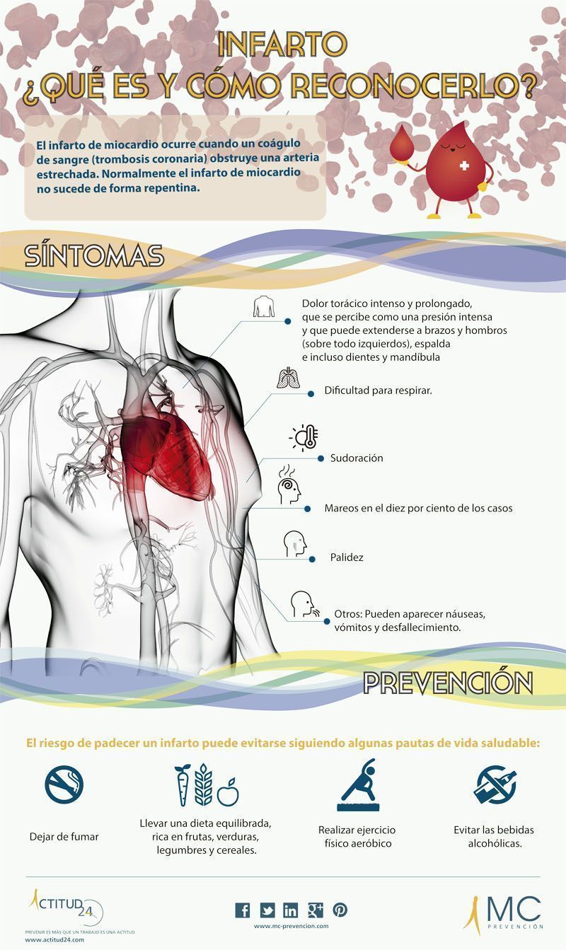 Infarto: ¿ Que es y cómo reconocerlo ?