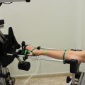 Unión de Mutua aplica la tecnología 3D para las fracturas óseas y lesiones musculares