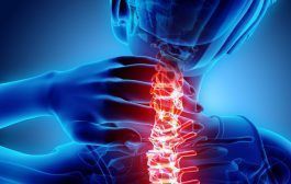 Plan integral para la disminución de trastornos musculoesqueléticos