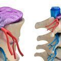 lesiones medulares
