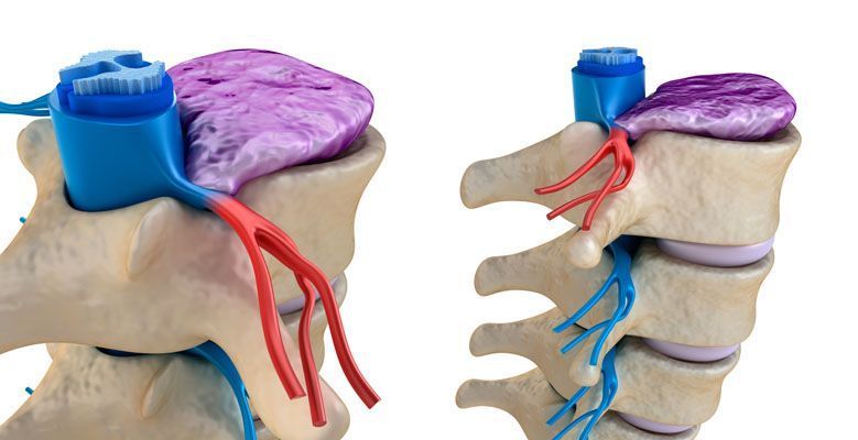 BSH reduce un 12 % las lesiones musculares gracias a su plan de salud