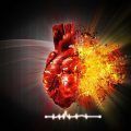 infarto