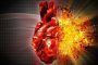 PrevenConsejo: ¿Qué puedo hacer para evitar un infarto o un accidente vascular cerebral?
