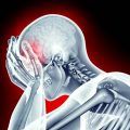 ictus