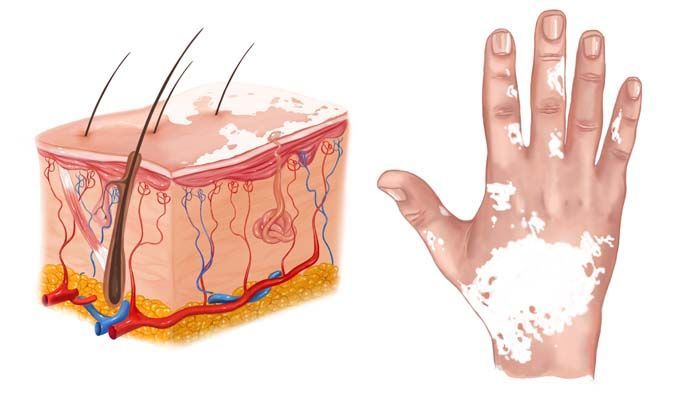 Guía sobre la dermatosis profesional en la construcción