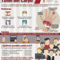 Síndrome del túnel carpiano