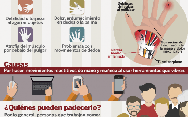 Infografía: Síndrome del túnel carpiano