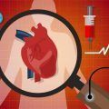 enfermedades cardiovasculares
