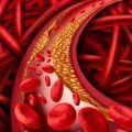 enfermedades cardiovasculares