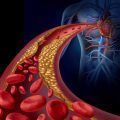 riesgo cardiovascular
