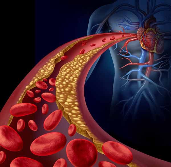 Guía para el manejo coordinado de trabajadores con cáncer y riesgo cardiovascular