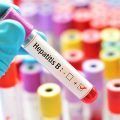hepatitis-b