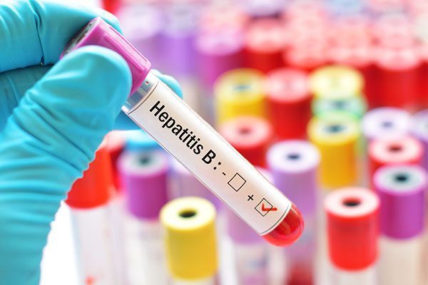 hepatitis-b