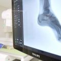 Asepeyo instala un equipo de radiología, pionero en el mundo, que ofrece más comodidad y seguridad al paciente