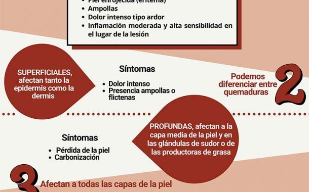 Infografía: ¡No dejes que el sol te queme!