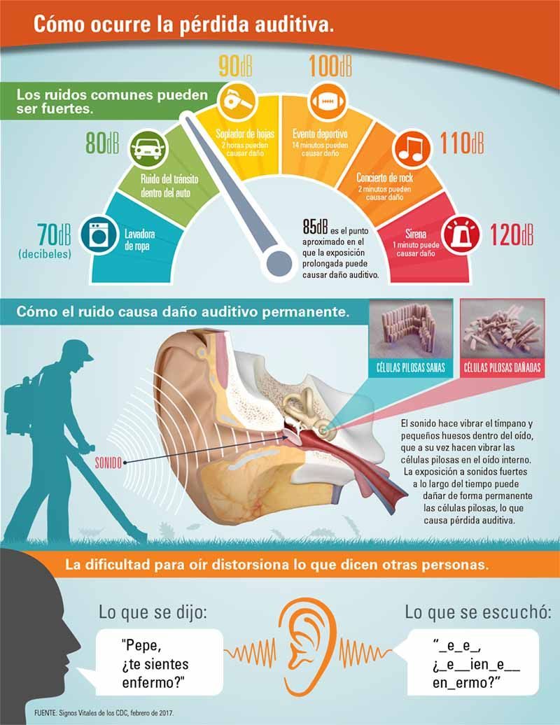 como ocurre la pérdida auditiva