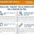 Signos de alerta del cáncer de piel: Regla del ABCDE