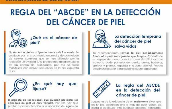 Signos de alerta del cáncer de piel: Regla del ABCDE