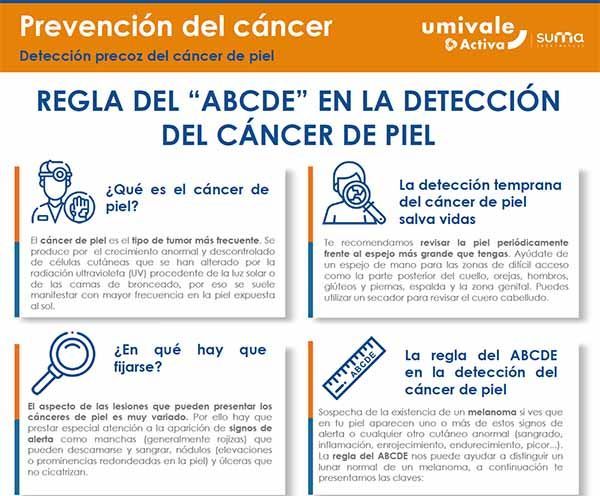 Signos de alerta del cáncer de piel: Regla del ABCDE