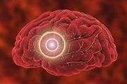 UGT alerta del aumento de fallecimientos por infartos y derrames cerebrales en el trabajo