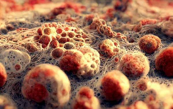 Encuesta sobre la exposición de los trabajadores a factores de riesgo de cáncer en Europa