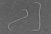 Diseño de una herramienta adaptada a los trabajadores de la captura de cangrejo rojo como prevención de leptospirosis