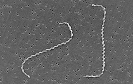 Diseño de una herramienta adaptada a los trabajadores de la captura de cangrejo rojo como prevención de leptospirosis