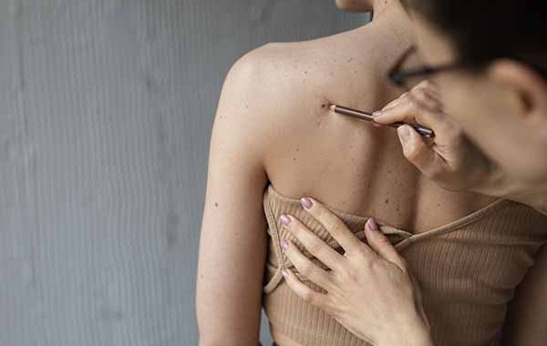 Diagnóstico dermatológico a golpe de foto: telemedicina para la detección precoz del cáncer