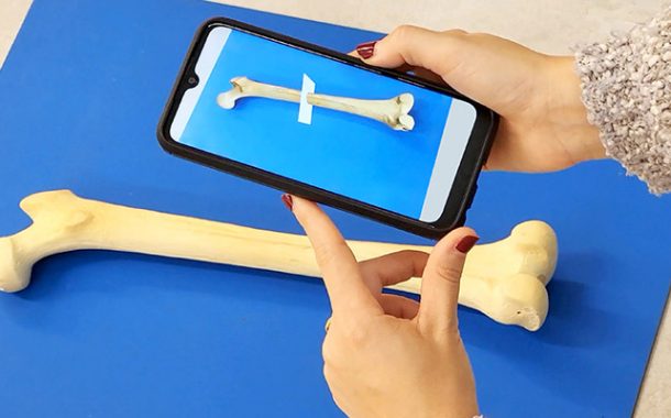 IBV trabaja con Realidad Extendida para la implantación de prótesis en pacientes amputados