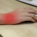 Sindrome Tunel Carpiano