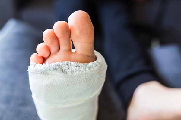 Los AT con baja por lesiones en los pies se han incrementado un 29'2%
